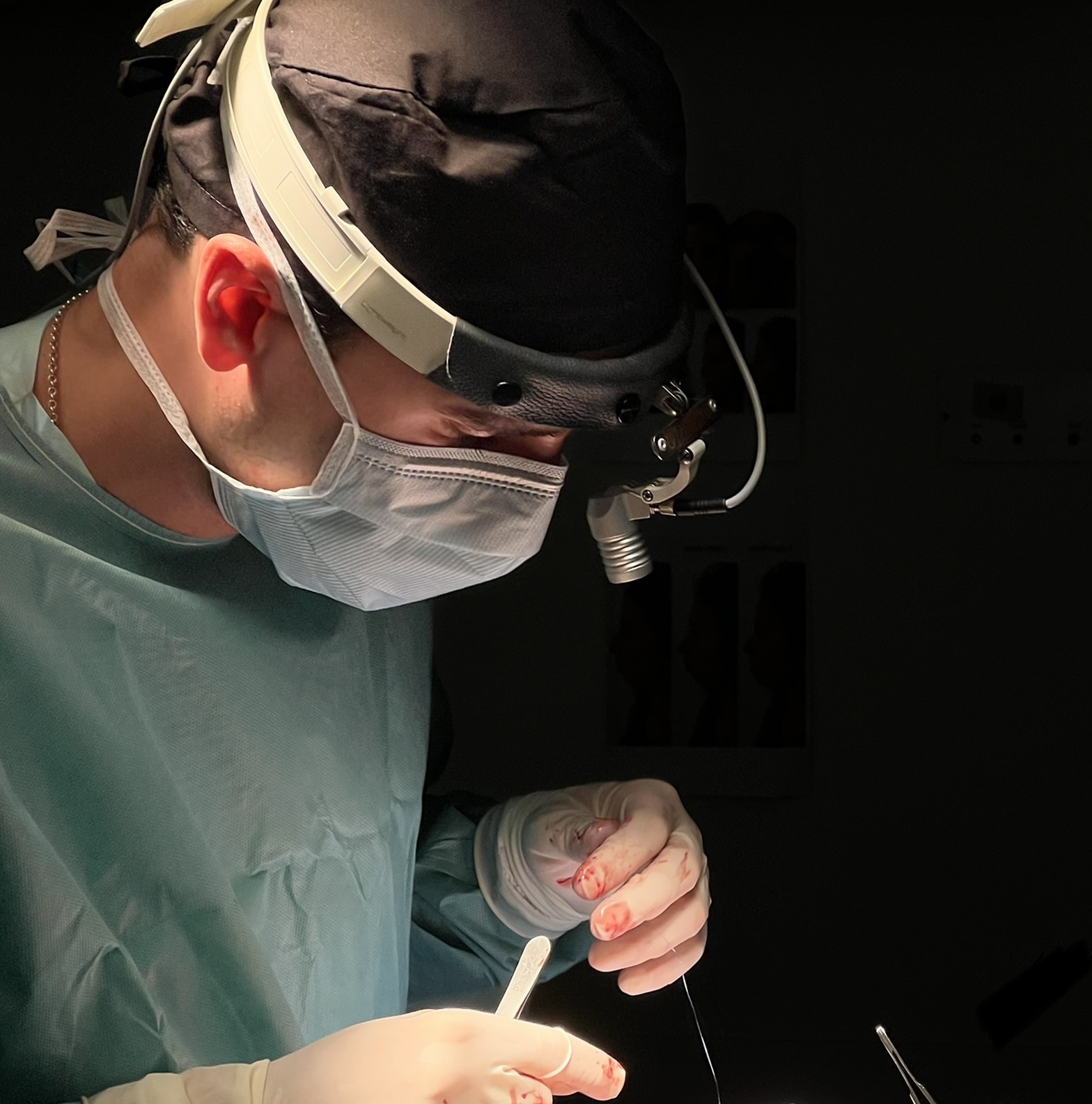 Rinoplastia